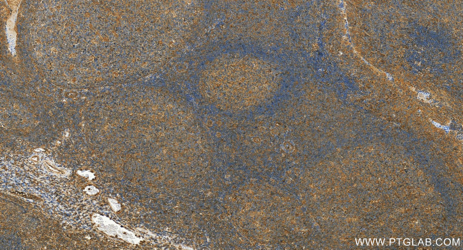 Immunohistochemistry (IHC) staining of human tonsillitis tissue using Siglec-7/CD328 Polyclonal antibody (13939-1-AP)