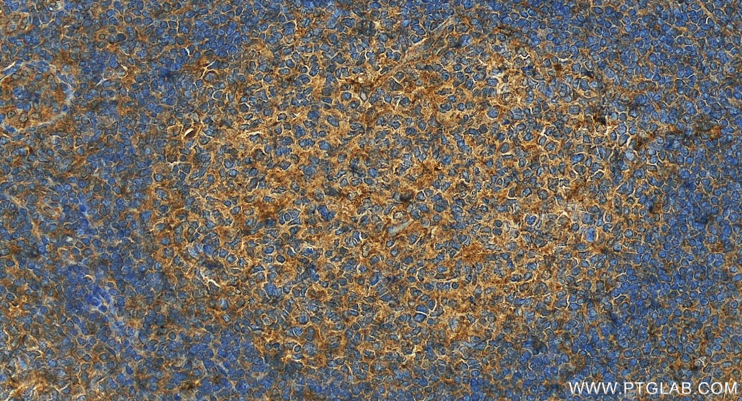 Immunohistochemistry (IHC) staining of human tonsillitis tissue using Siglec-7/CD328 Polyclonal antibody (13939-1-AP)