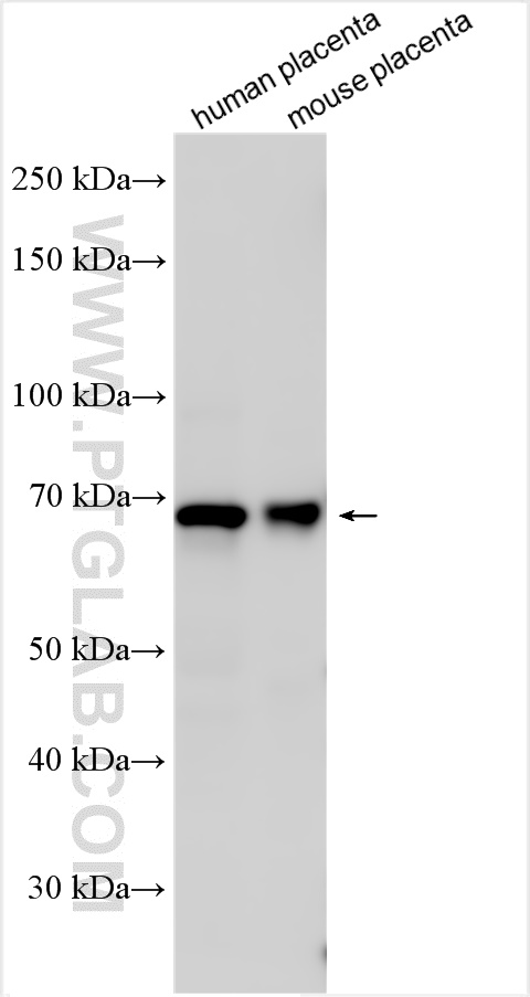 Western Blot (WB) analysis of various lysates using Siglec-7 Polyclonal antibody (13939-1-AP)