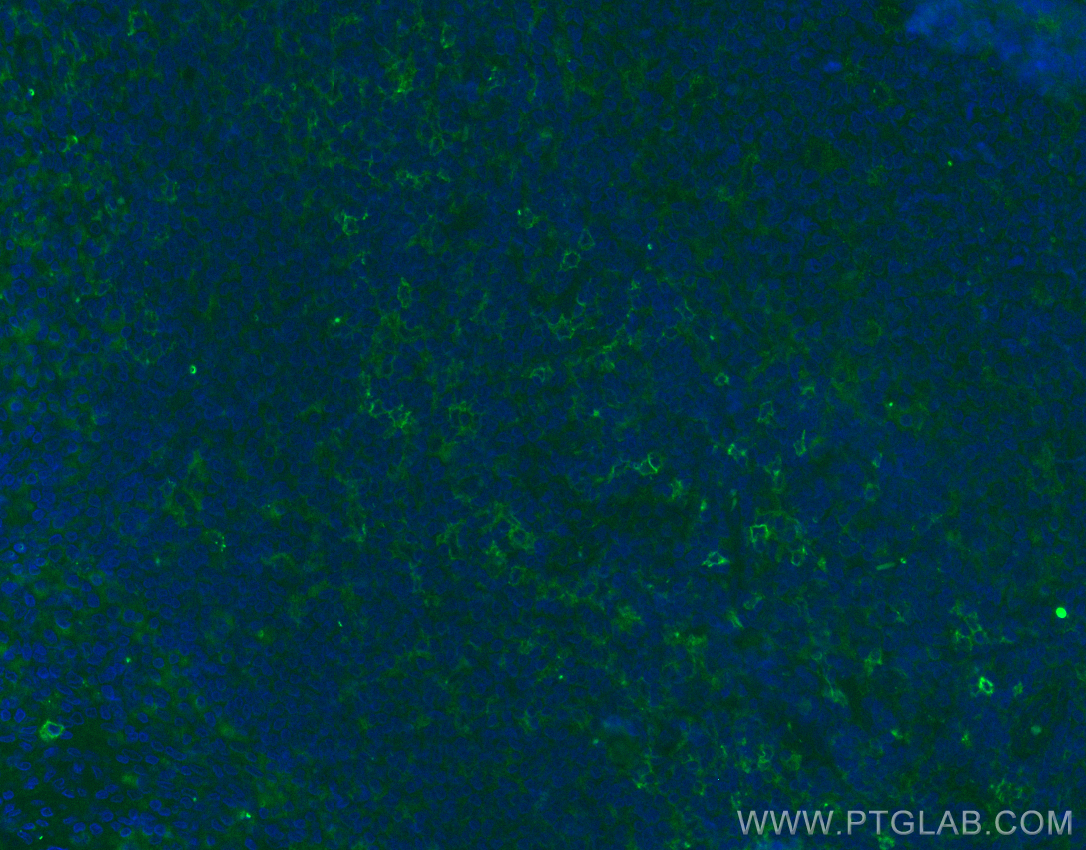 Immunofluorescence (IF) / fluorescent staining of human tonsillitis tissue using Siglec-9 Polyclonal antibody (13377-1-AP)