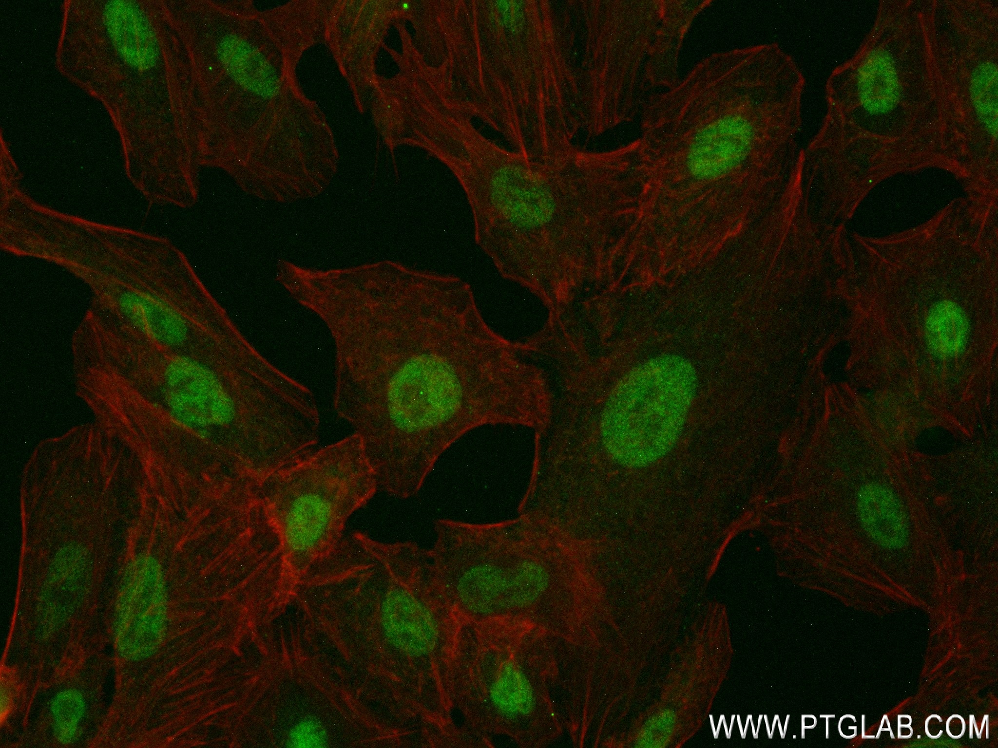 Immunofluorescence (IF) / fluorescent staining of A549 cells using SIK1 Recombinant antibody (83897-4-RR)