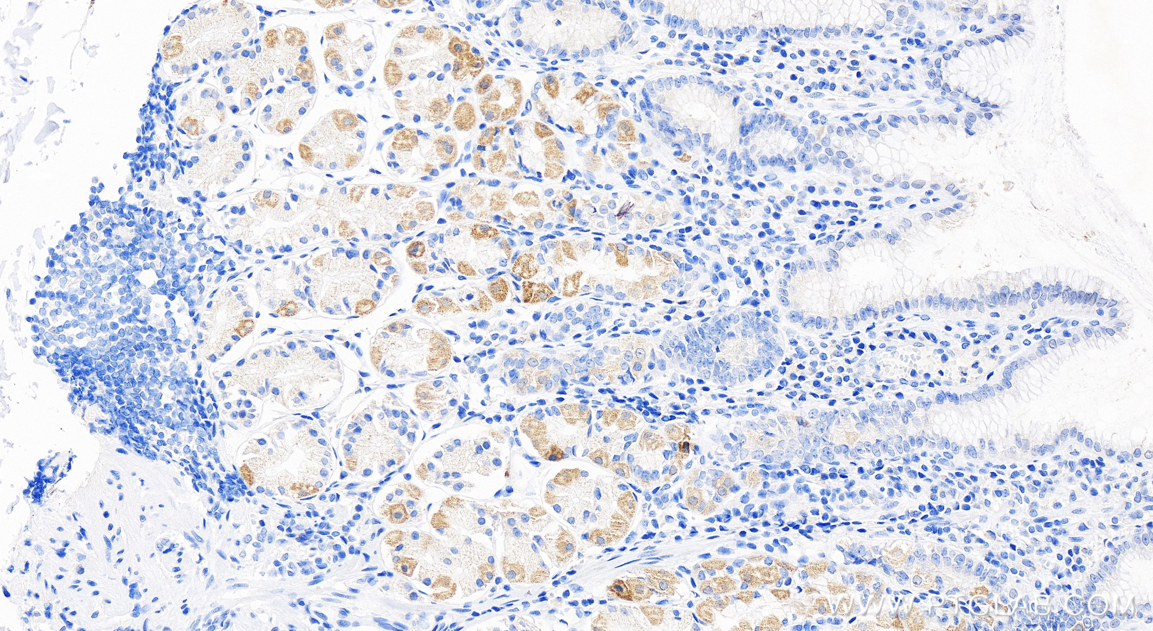 Immunohistochemistry (IHC) staining of human stomach tissue using SIK1 Recombinant antibody (83897-4-RR)