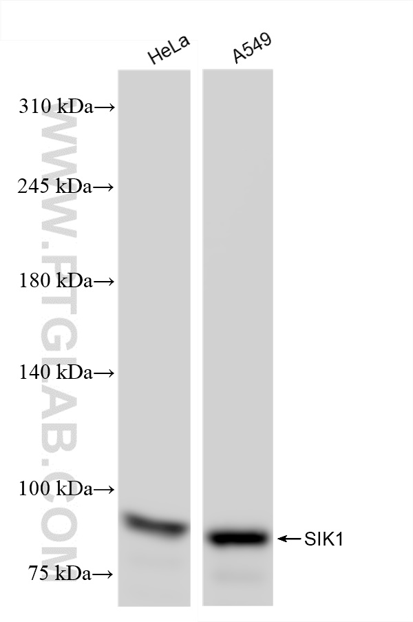 Western Blot (WB) analysis of various lysates using SIK1 Recombinant antibody (83897-4-RR)