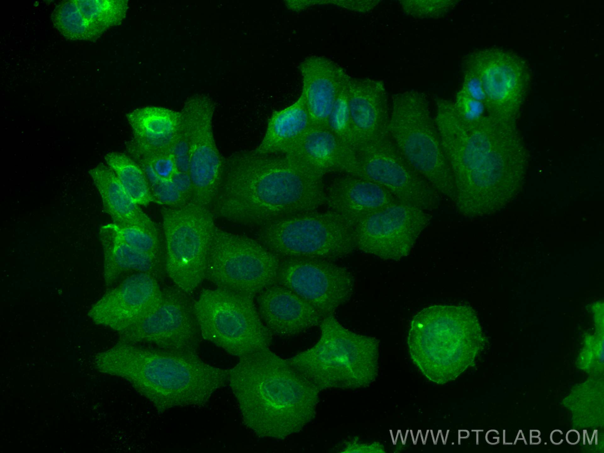 Immunofluorescence (IF) / fluorescent staining of MCF-7 cells using SIPA1 Polyclonal antibody (26793-1-AP)