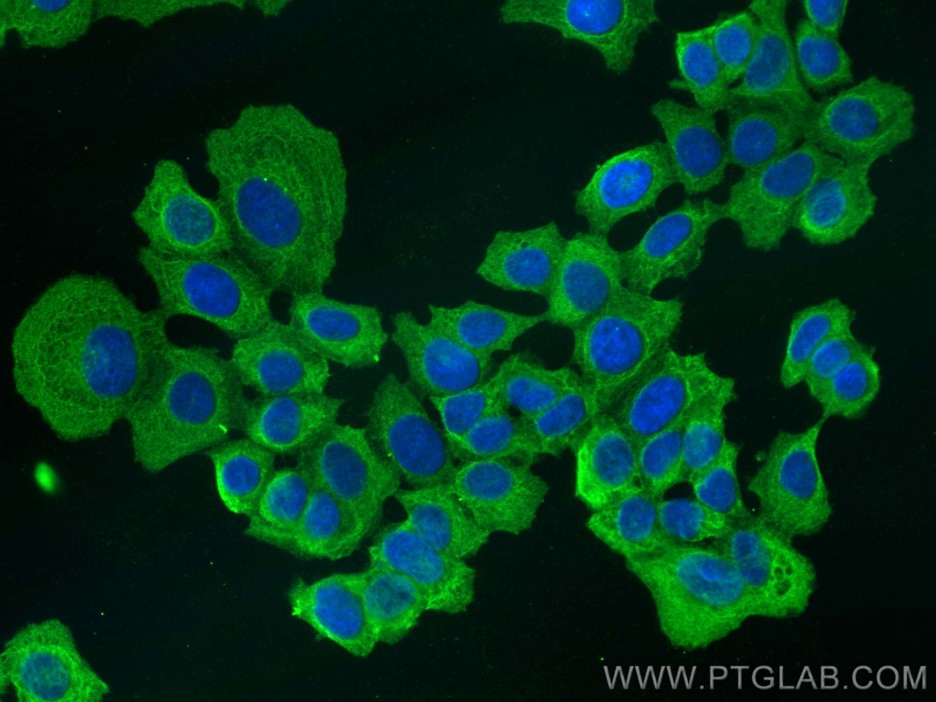 Immunofluorescence (IF) / fluorescent staining of MCF-7 cells using SIPA1 Polyclonal antibody (26793-1-AP)