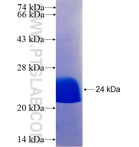 SIPA1 fusion protein Ag25404 SDS-PAGE