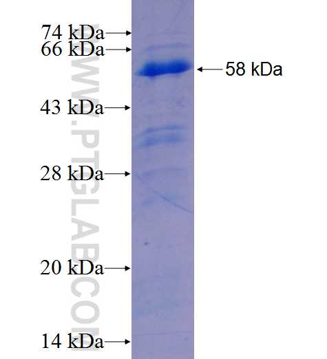 SIPA1L2 fusion protein Ag25856 SDS-PAGE