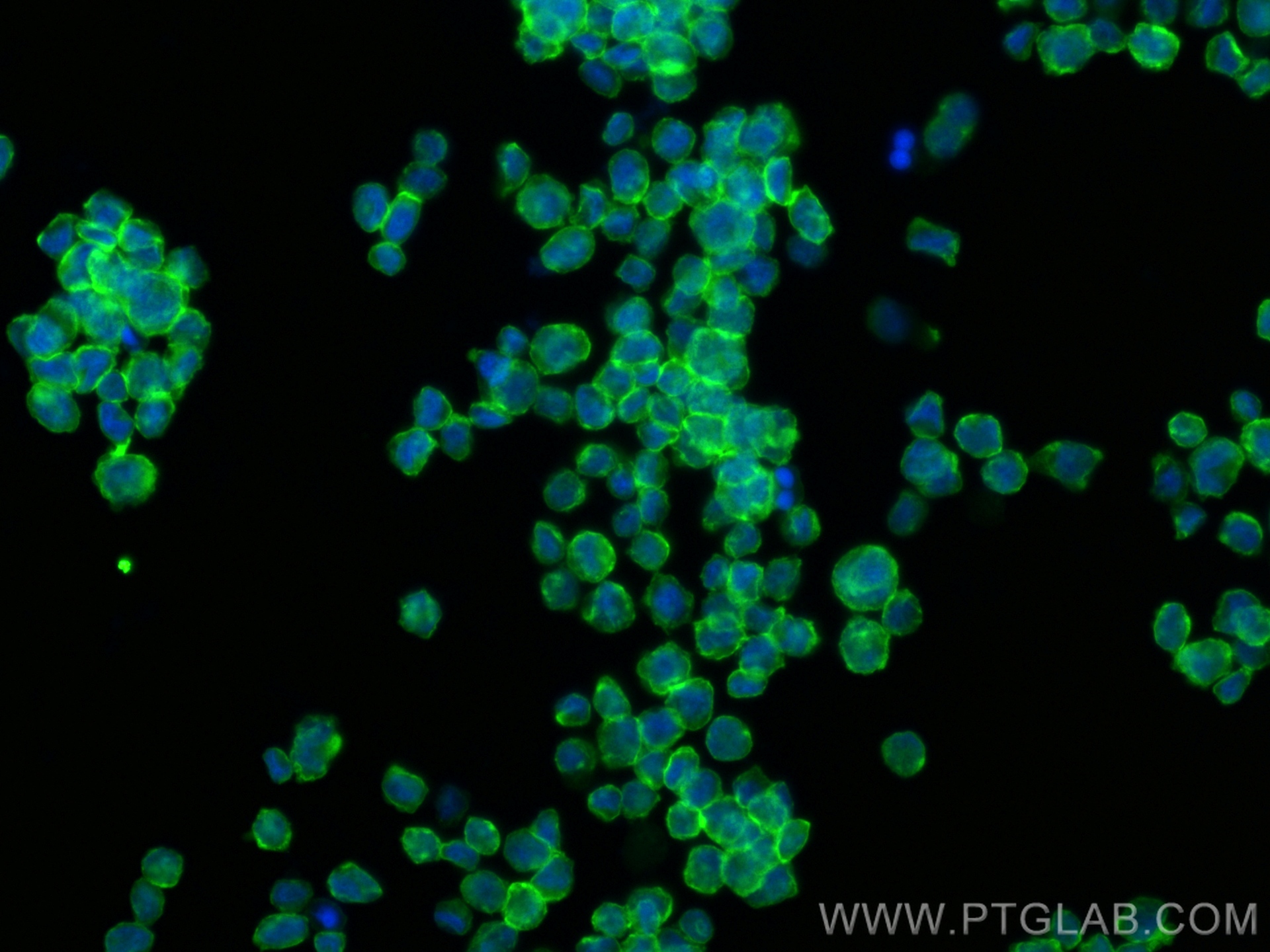 Immunofluorescence (IF) / fluorescent staining of THP-1 cells using SIRP Alpha/CD172a Polyclonal antibody (31485-1-AP)