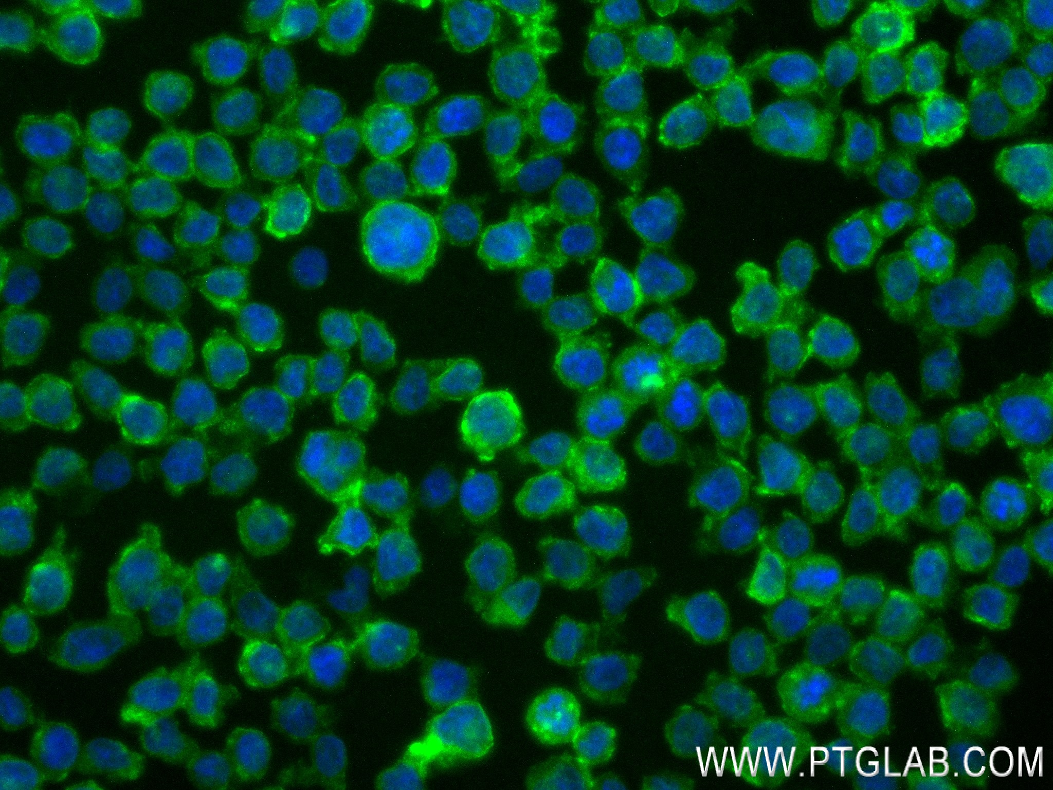 Immunofluorescence (IF) / fluorescent staining of THP-1 cells using SIRP Alpha/CD172a Recombinant antibody (83729-5-RR)