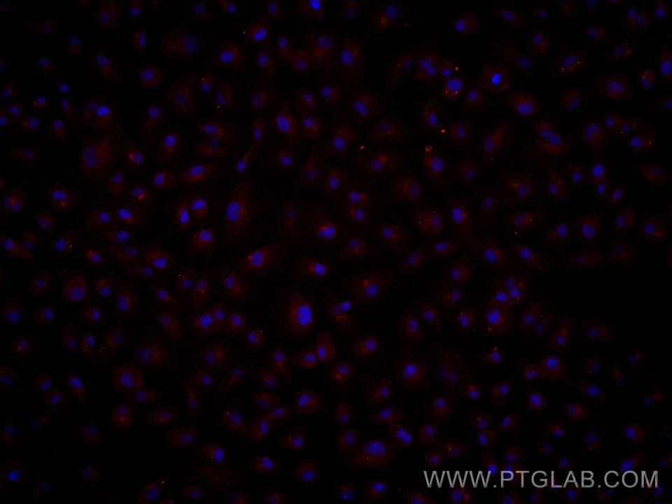 Immunofluorescence (IF) / fluorescent staining of OS-RC-2 cells using SIRP beta 1/CD172b Monoclonal antibody (68206-1-Ig)