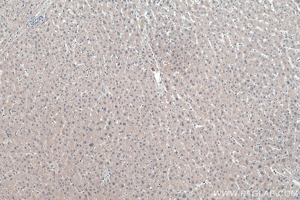 Immunohistochemistry (IHC) staining of human liver tissue using SIRP Alpha/CD172a Monoclonal antibody (67337-1-Ig)