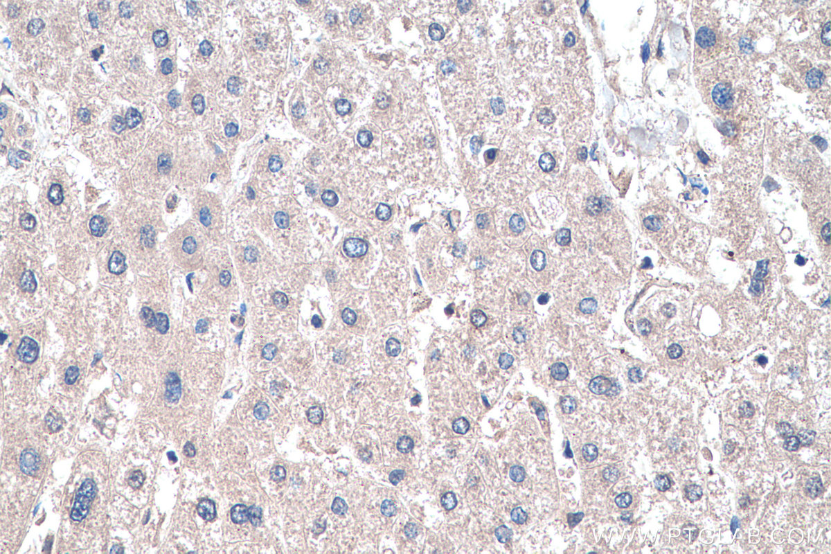 Immunohistochemistry (IHC) staining of human liver tissue using SIRP Alpha/CD172a Monoclonal antibody (67337-1-Ig)