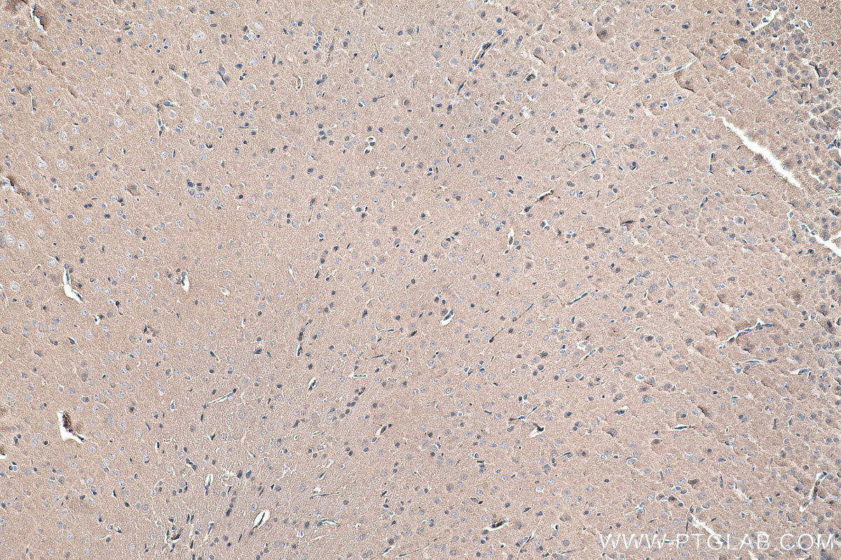 Immunohistochemistry (IHC) staining of rat brain tissue using SIRP Alpha/CD172a Monoclonal antibody (67337-1-Ig)