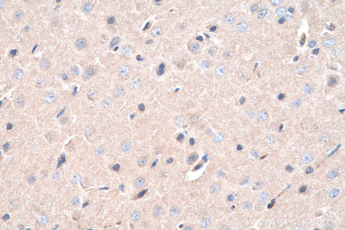 Immunohistochemistry (IHC) staining of rat brain tissue using SIRP Alpha/CD172a Monoclonal antibody (67337-1-Ig)