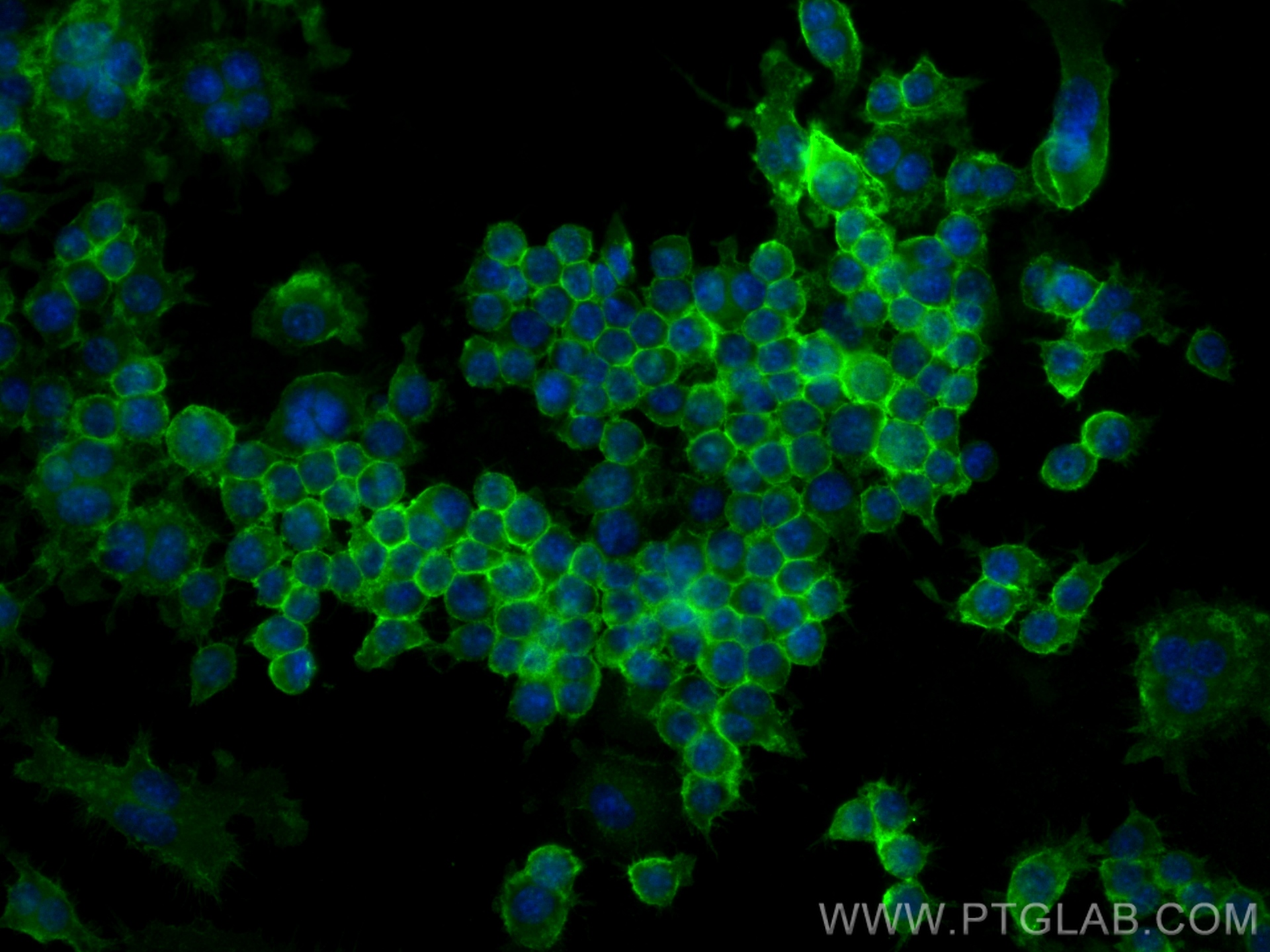 Immunofluorescence (IF) / fluorescent staining of RAW 264.7 cells using SIRP alpha/CD172a Polyclonal antibody (31952-1-AP)