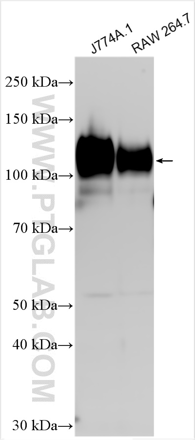 Western Blot (WB) analysis of various lysates using SIRP alpha/CD172a Polyclonal antibody (31952-1-AP)