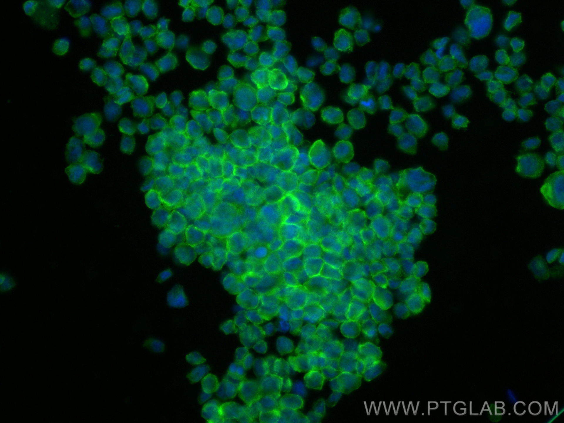 Immunofluorescence (IF) / fluorescent staining of THP-1 cells using SIRP Alpha/CD172a Polyclonal antibody (14482-1-AP)