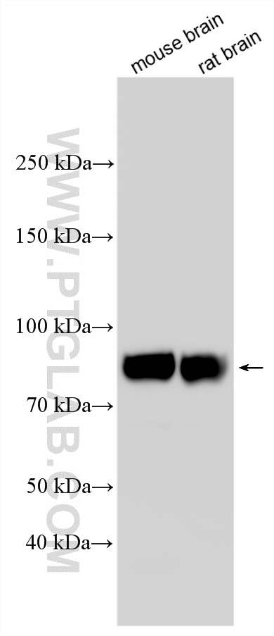 Western Blot (WB) analysis of various lysates using SIRP Alpha/CD172a Polyclonal antibody (14482-1-AP)