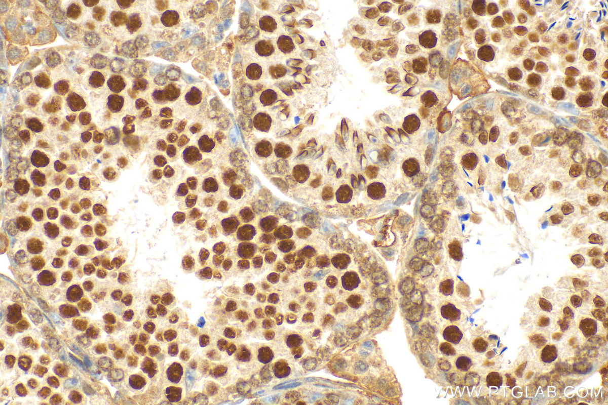 Immunohistochemistry (IHC) staining of mouse testis tissue using SIRT1 Polyclonal antibody (13161-1-AP)