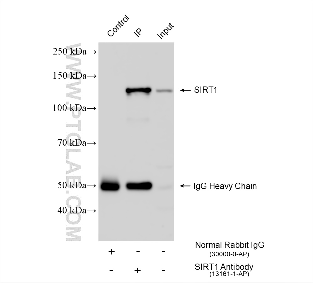 Immunoprecipitation (IP) experiment of HeLa cells using SIRT1 Polyclonal antibody (13161-1-AP)
