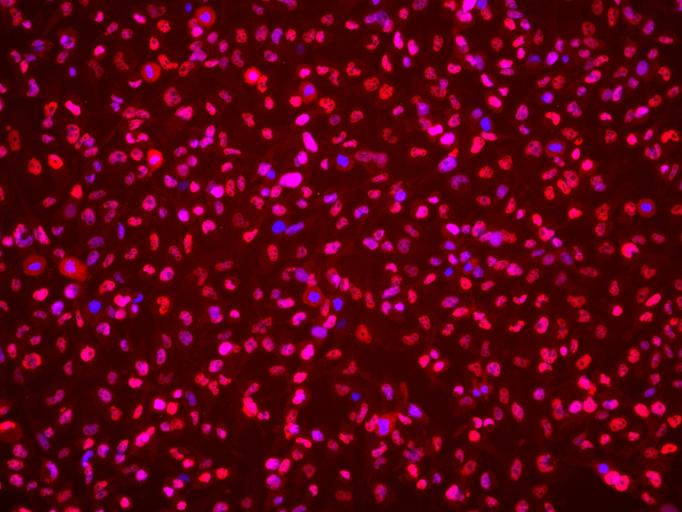 Immunofluorescence (IF) / fluorescent staining of BT-549 cells using SIRT1 Monoclonal antibody (60303-1-Ig)