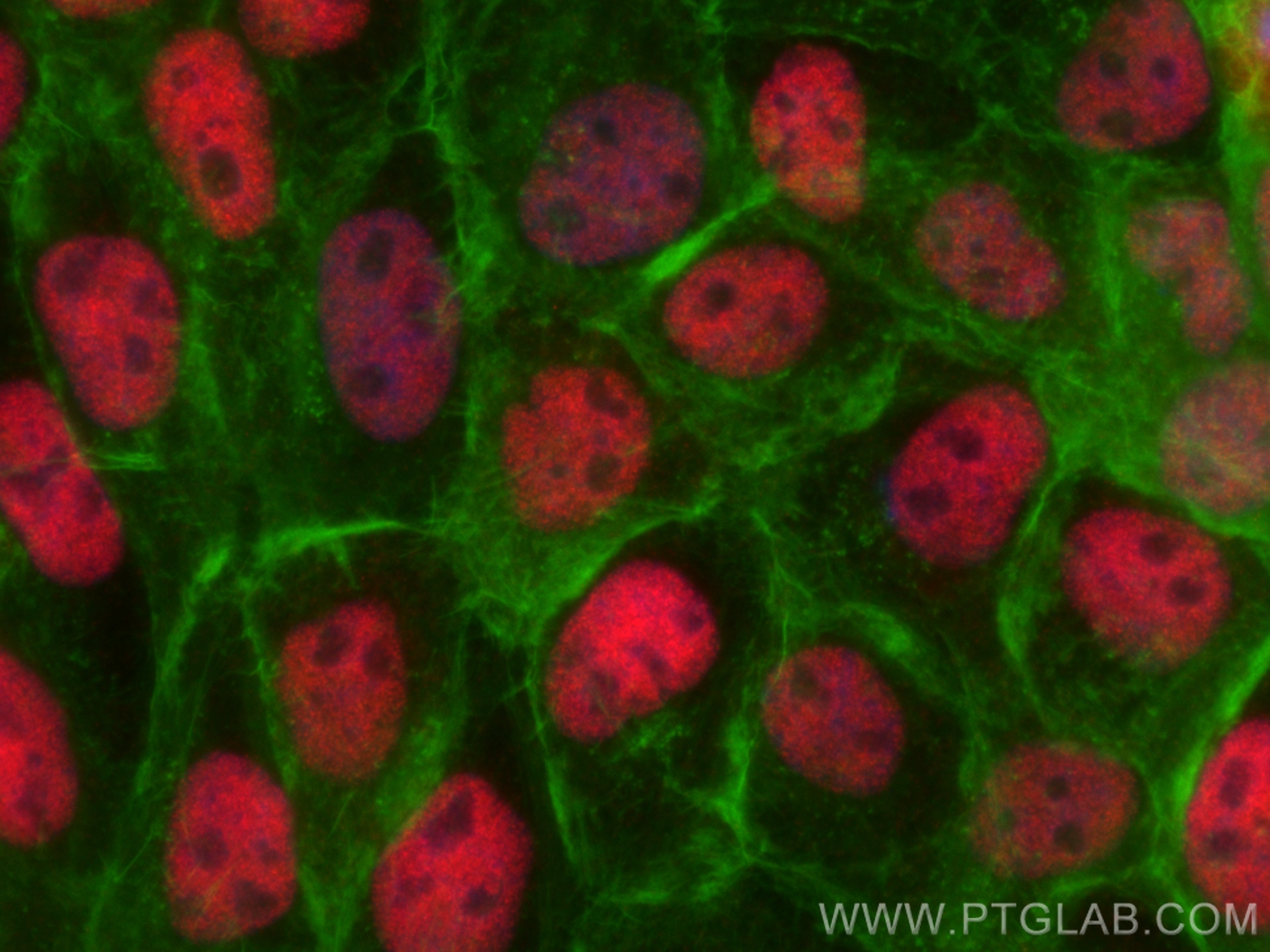 Immunofluorescence (IF) / fluorescent staining of A431 cells using Multi-rAb™ SIRT1 Multi-Recombinant antibody (RMX00009)