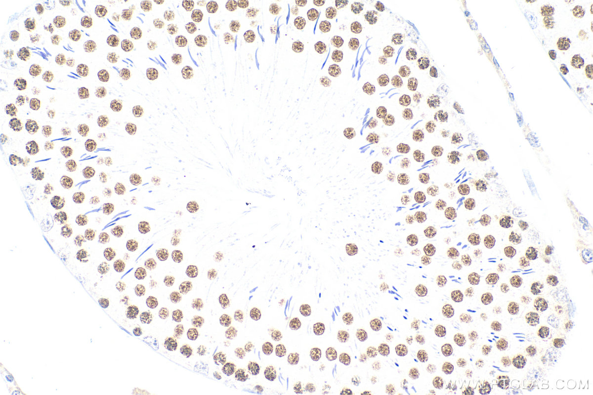 Immunohistochemistry (IHC) staining of rat testis tissue using Multi-rAb™ SIRT1 Multi-Recombinant antibody (RMX00009)