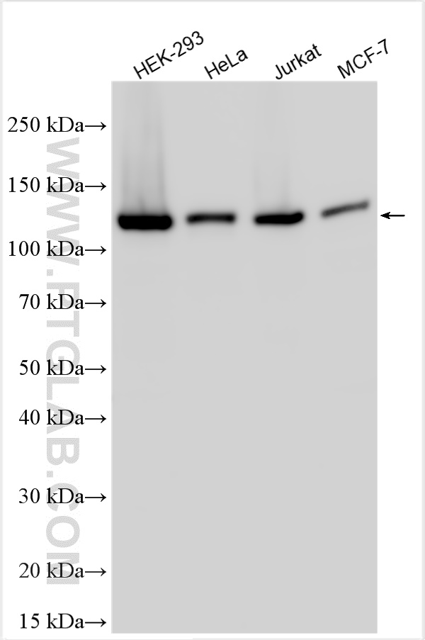 Western Blot (WB) analysis of various lysates using Multi-rAb™ SIRT1 Multi-Recombinant antibody (RMX00009)