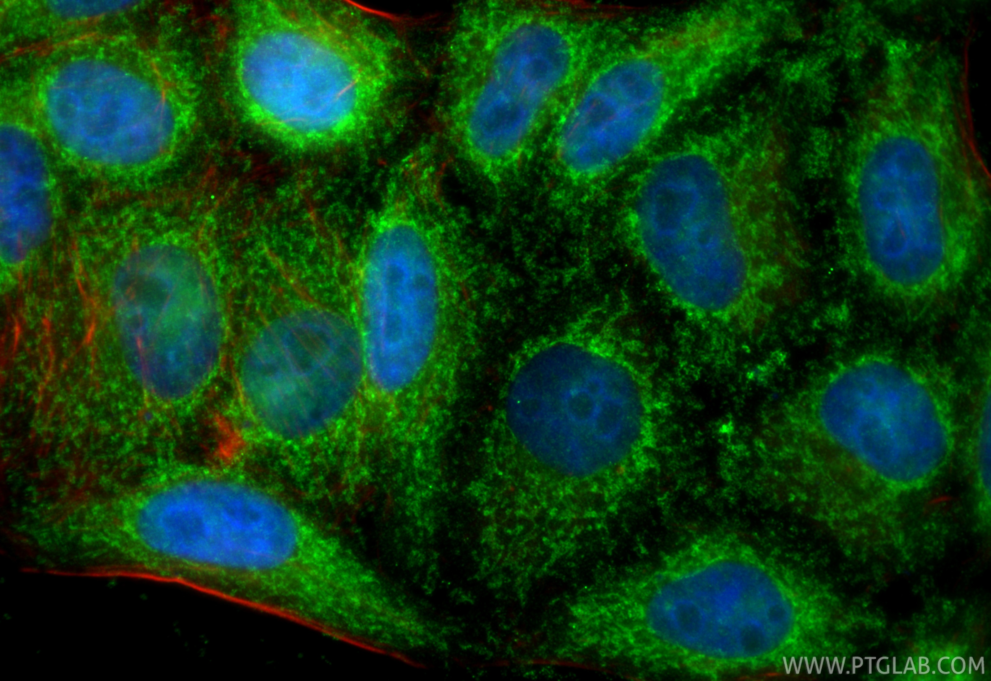 Immunofluorescence (IF) / fluorescent staining of HepG2 cells using SIRT5 Polyclonal antibody (15122-1-AP)