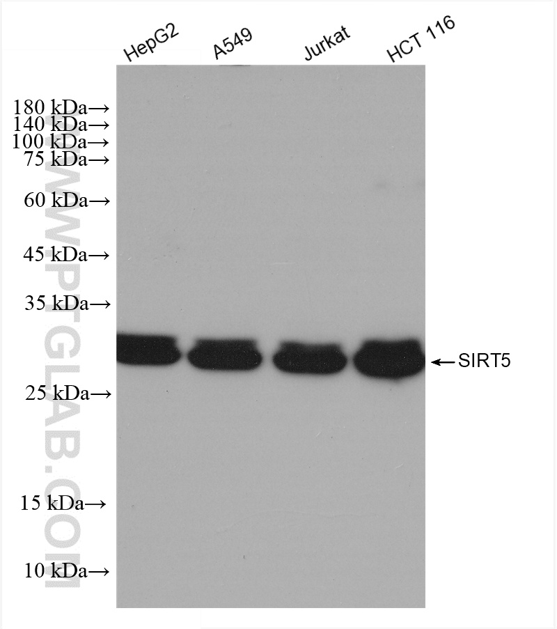 Western Blot (WB) analysis of various lysates using SIRT5 Recombinant antibody (82246-1-RR)