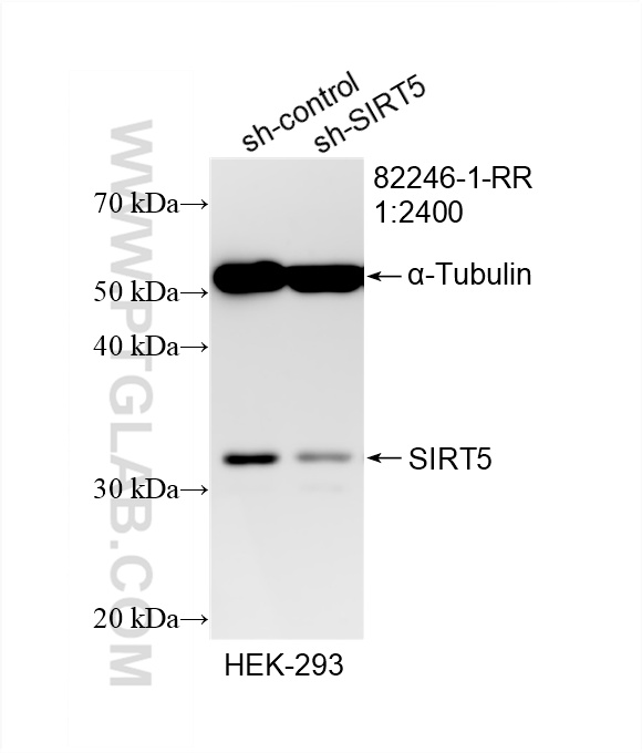 Western Blot (WB) analysis of HEK-293 cells using SIRT5 Recombinant antibody (82246-1-RR)