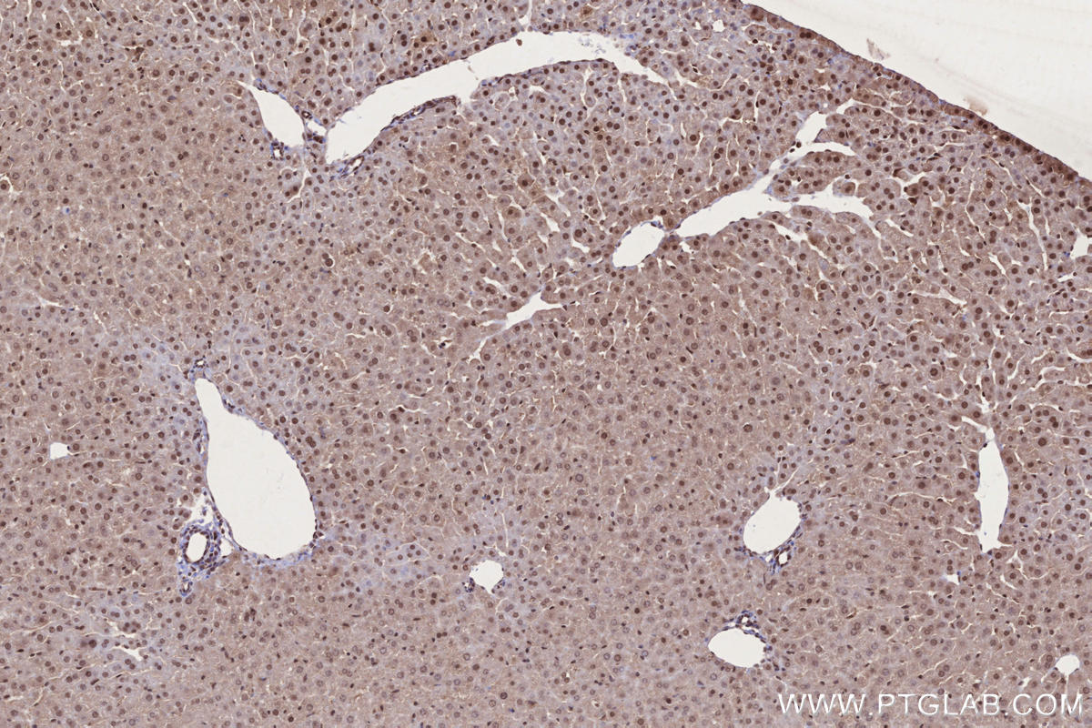 Immunohistochemistry (IHC) staining of mouse liver tissue using SIRT6 Polyclonal antibody (28677-1-AP)