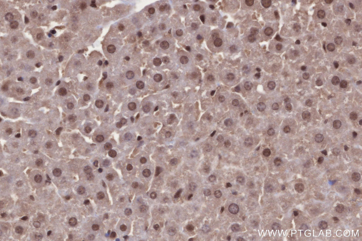 Immunohistochemistry (IHC) staining of mouse liver tissue using SIRT6 Polyclonal antibody (28677-1-AP)