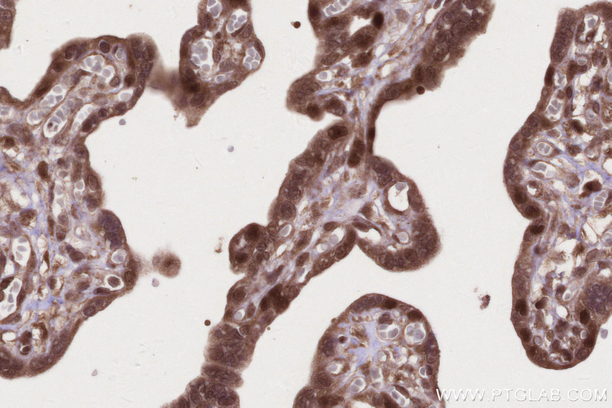 Immunohistochemistry (IHC) staining of human placenta tissue using SIRT6 Polyclonal antibody (28677-1-AP)