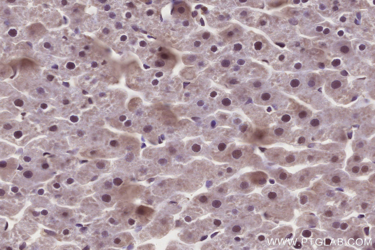 Immunohistochemistry (IHC) staining of rat liver tissue using SIRT6 Polyclonal antibody (28677-1-AP)