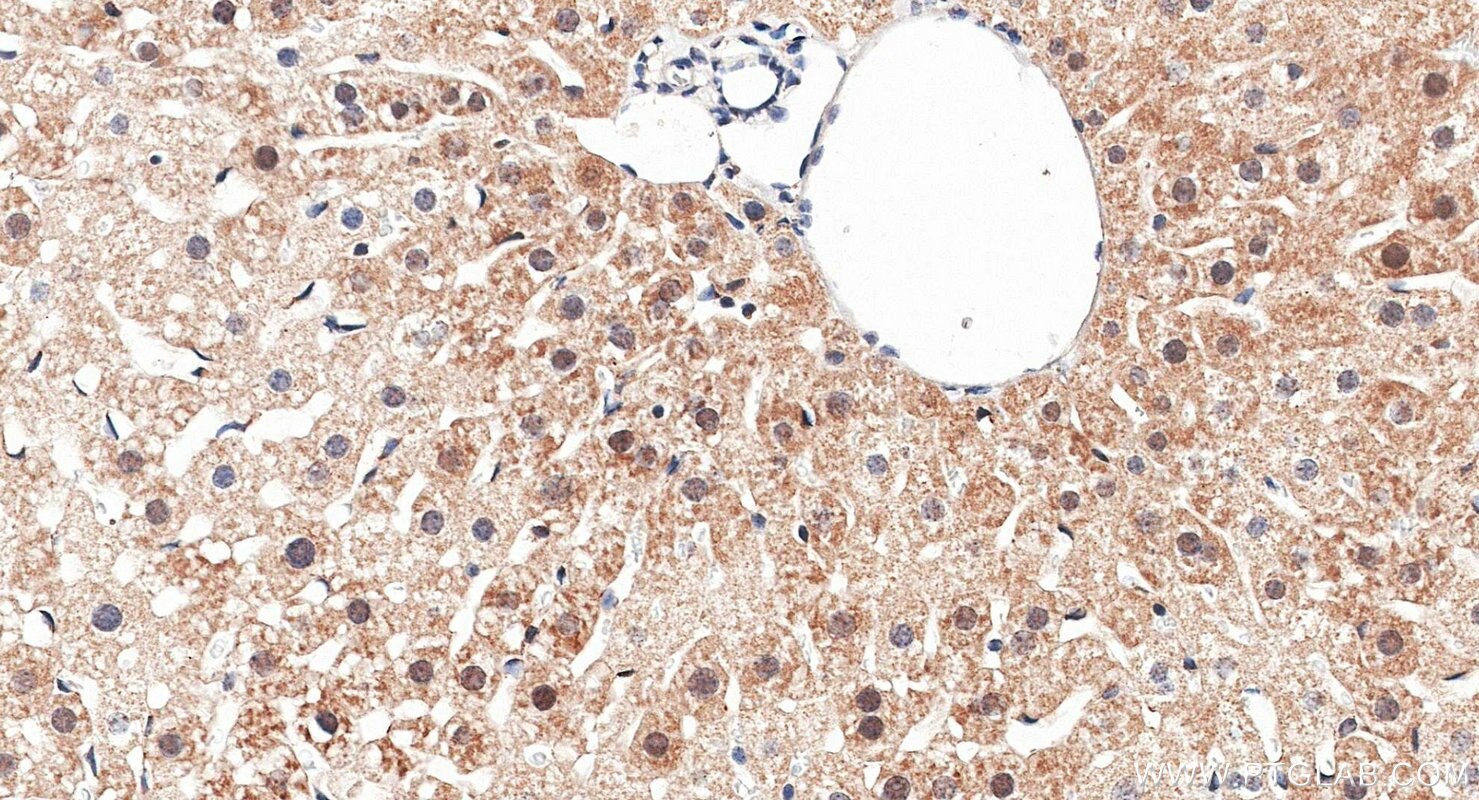 Immunohistochemistry (IHC) staining of mouse liver tissue using SIRT6 Polyclonal antibody (28677-1-AP)