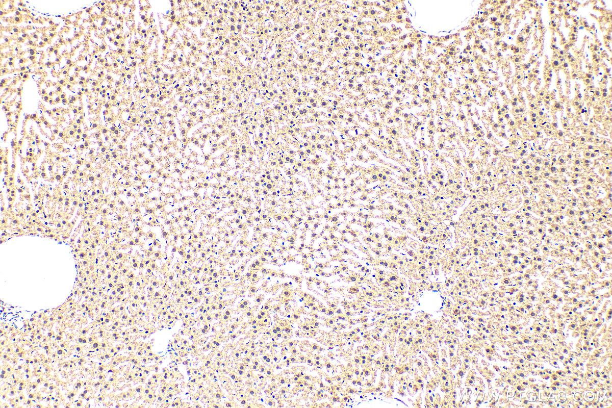 Immunohistochemistry (IHC) staining of mouse liver tissue using SIRT7 Polyclonal antibody (12994-1-AP)