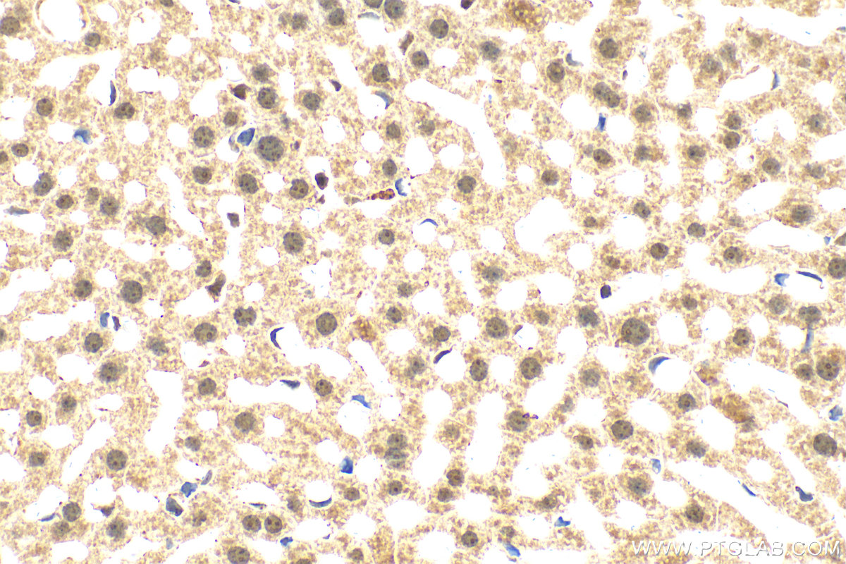 Immunohistochemistry (IHC) staining of mouse liver tissue using SIRT7 Polyclonal antibody (12994-1-AP)