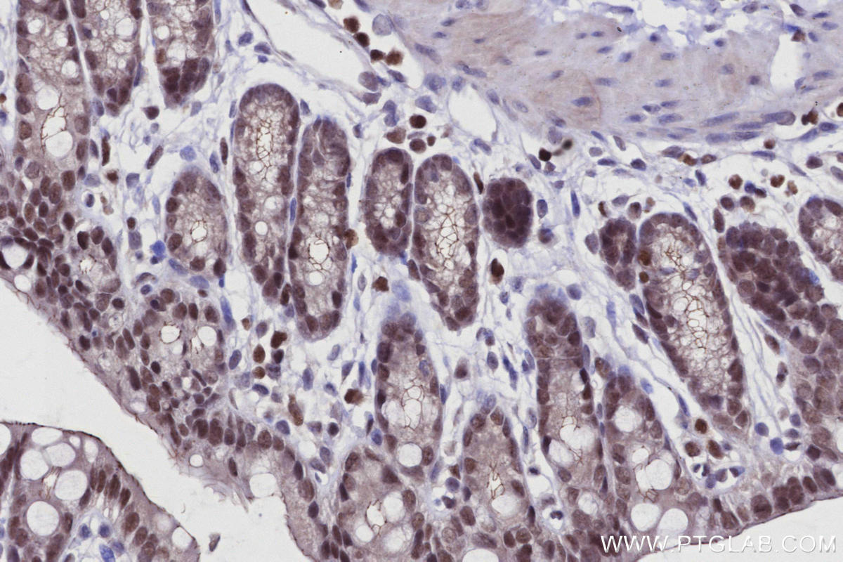 Immunohistochemistry (IHC) staining of mouse colon tissue using SIRT7 Polyclonal antibody (12994-1-AP)