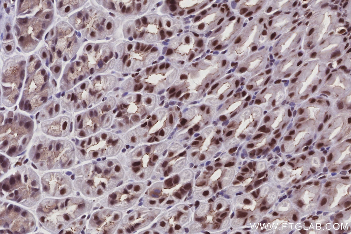 Immunohistochemistry (IHC) staining of mouse stomach tissue using SIRT7 Polyclonal antibody (12994-1-AP)