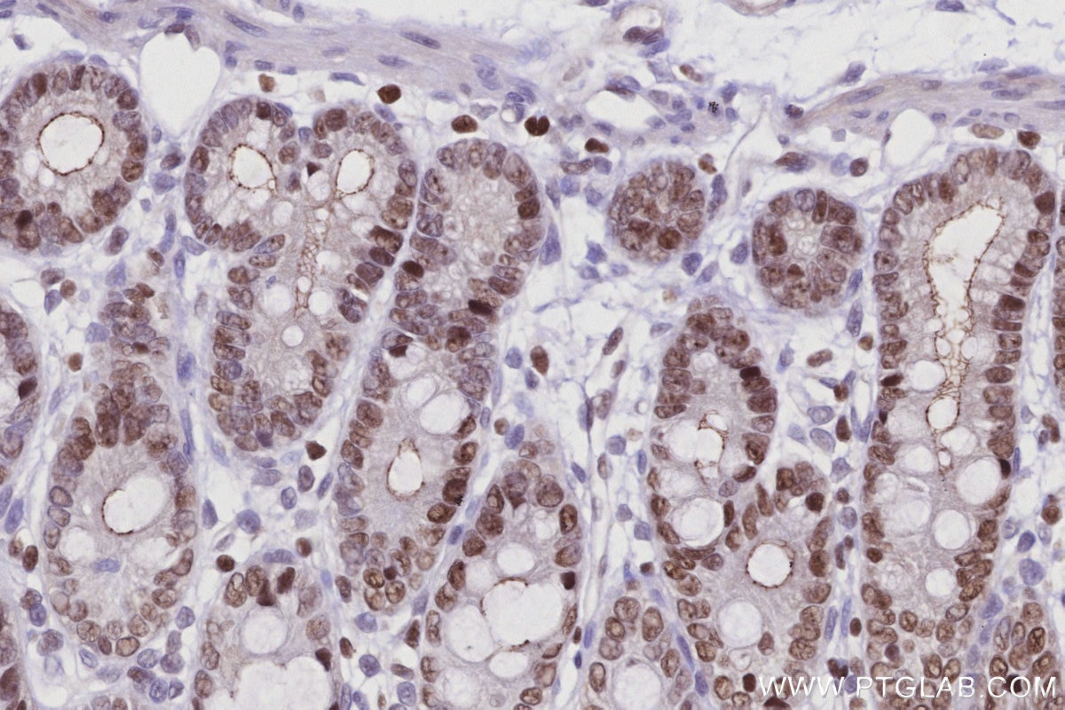 Immunohistochemistry (IHC) staining of rat colon tissue using SIRT7 Polyclonal antibody (12994-1-AP)