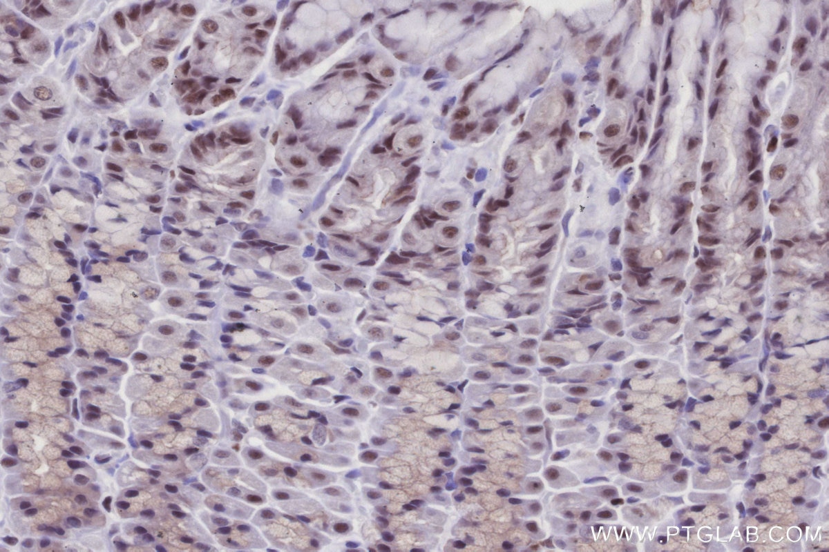 Immunohistochemistry (IHC) staining of rat stomach tissue using SIRT7 Polyclonal antibody (12994-1-AP)