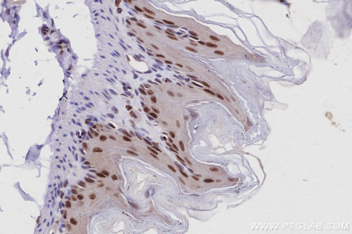 Immunohistochemistry (IHC) staining of mouse stomach tissue using SIRT7 Polyclonal antibody (12994-1-AP)
