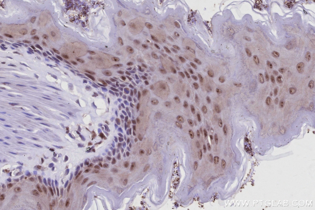 Immunohistochemistry (IHC) staining of rat stomach tissue using SIRT7 Polyclonal antibody (12994-1-AP)