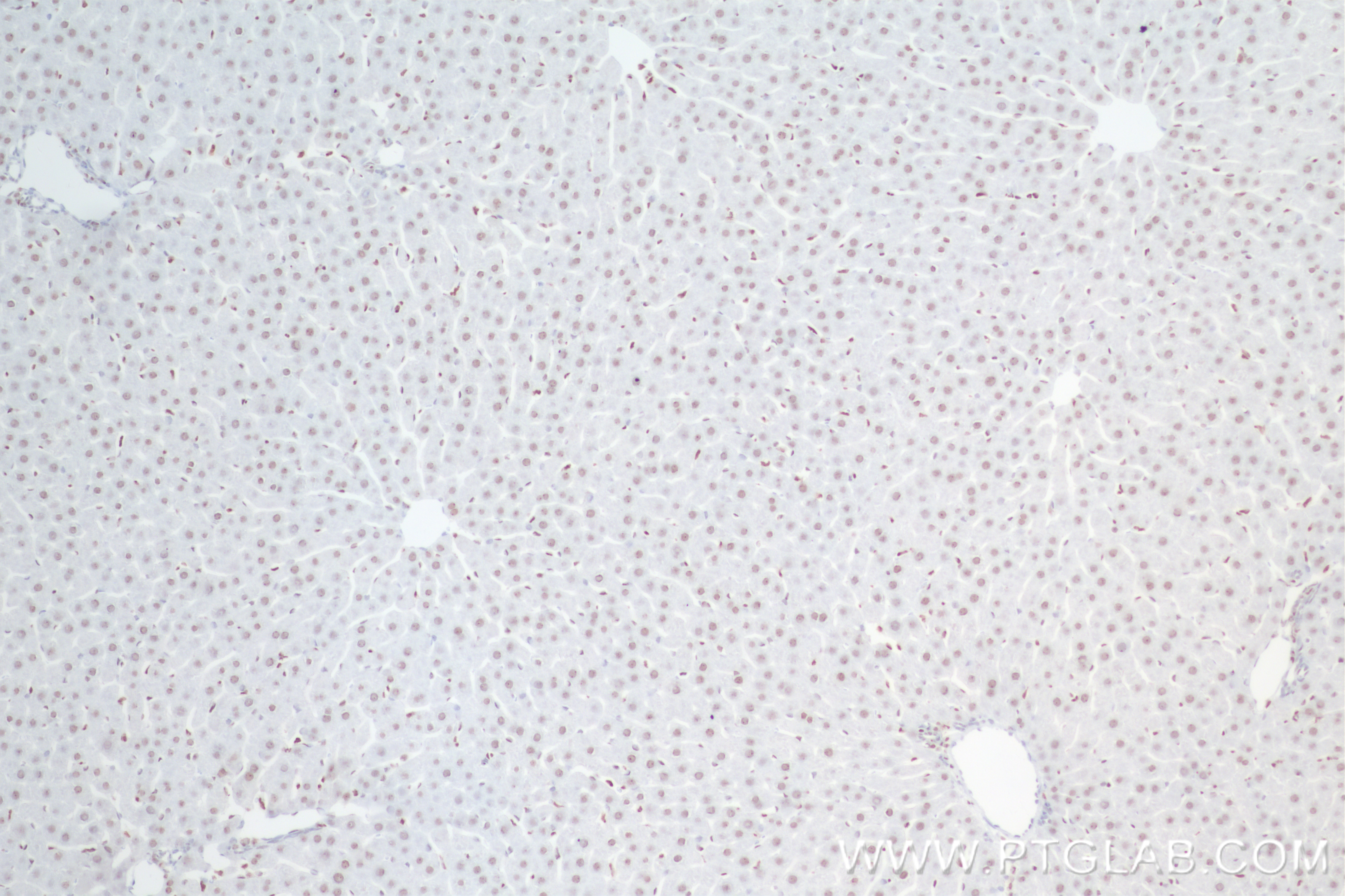 Immunohistochemistry (IHC) staining of rat liver tissue using SIRT7 Recombinant antibody (84805-4-RR)