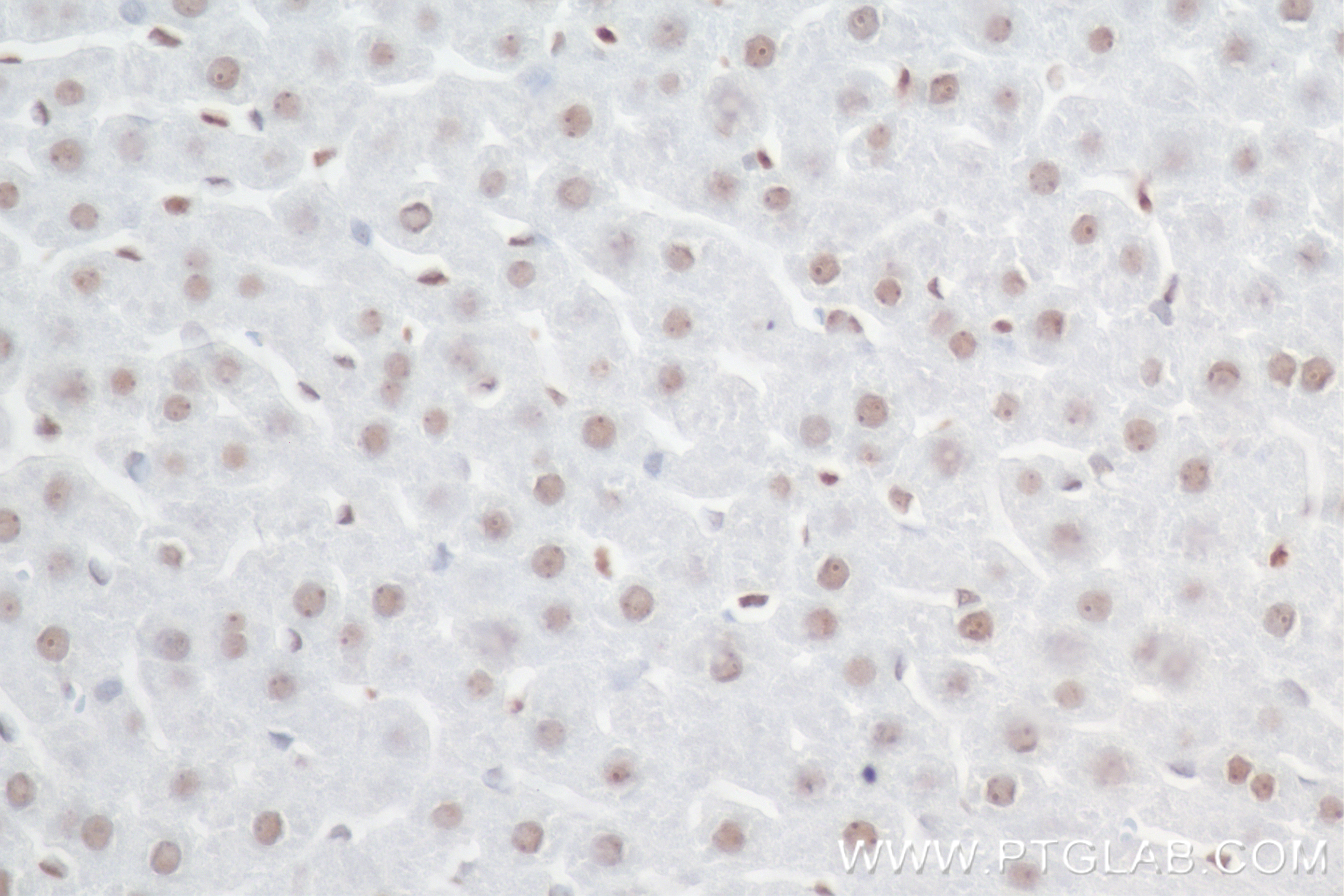 Immunohistochemistry (IHC) staining of rat liver tissue using SIRT7 Recombinant antibody (84805-4-RR)