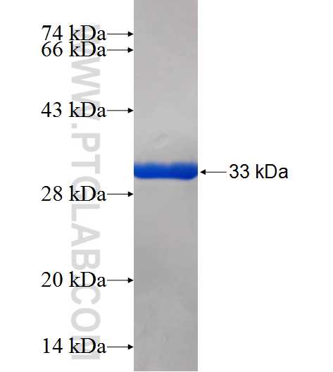 SIVA1 fusion protein Ag25748 SDS-PAGE