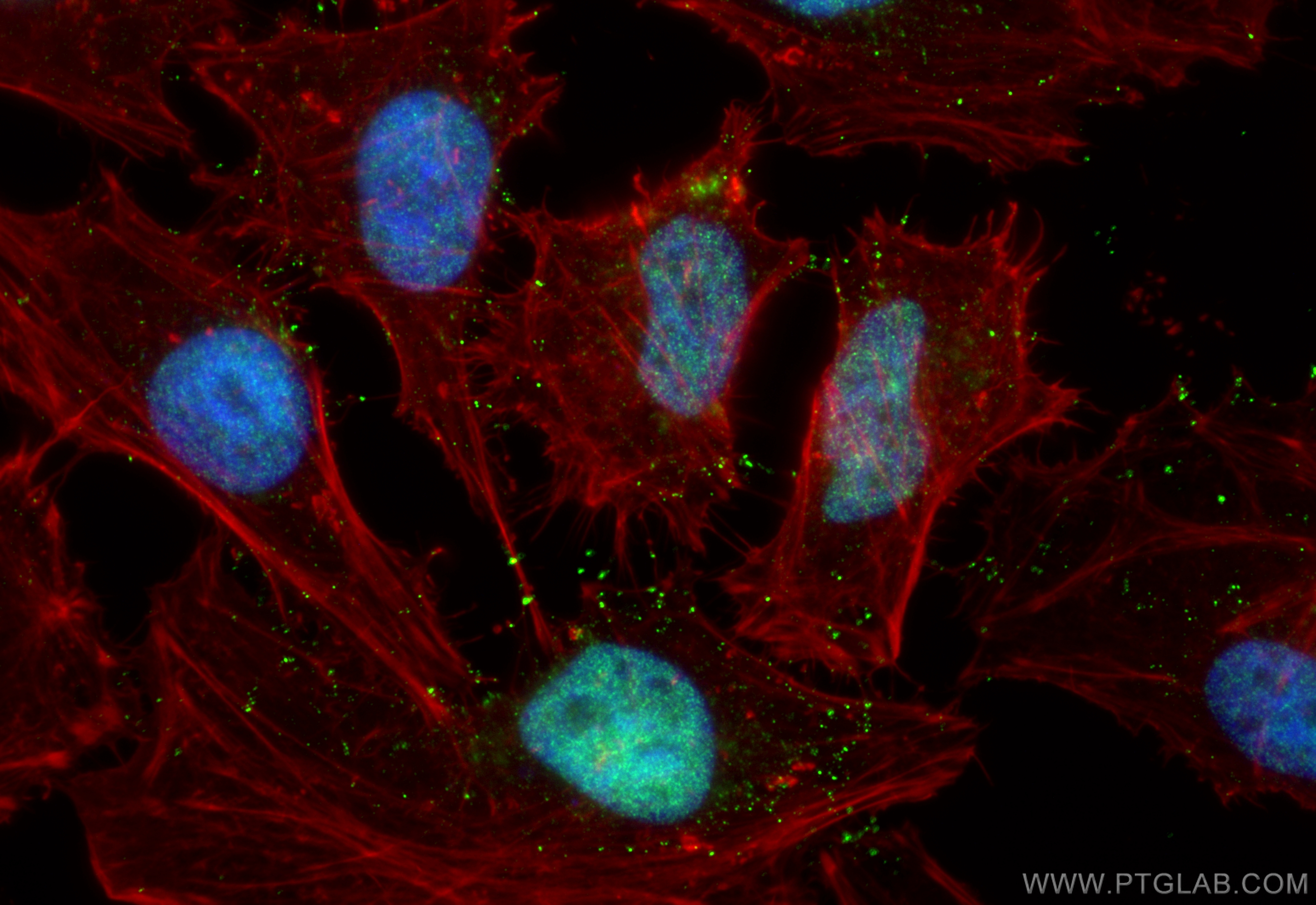 Immunofluorescence (IF) / fluorescent staining of HeLa cells using SIX2 Monoclonal antibody (66347-1-Ig)
