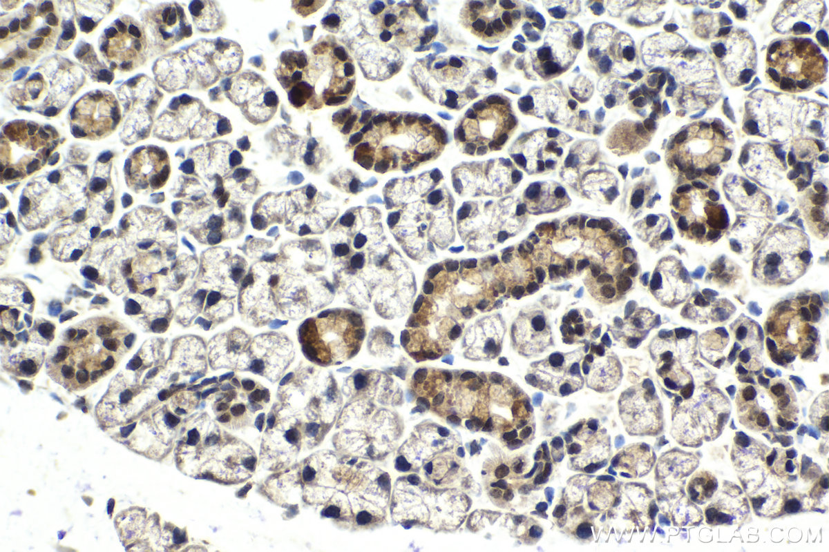 Immunohistochemistry (IHC) staining of mouse salivary gland tissue using SIX4 Polyclonal antibody (21305-1-AP)