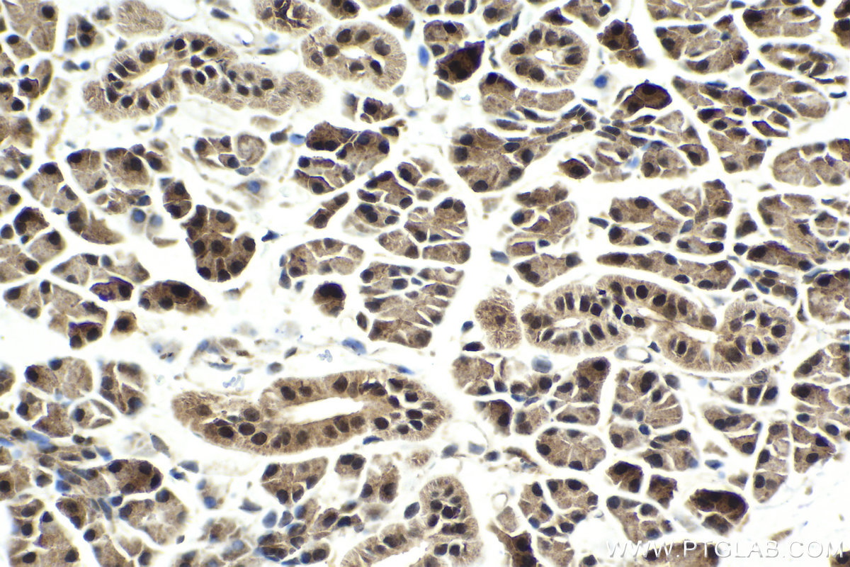 Immunohistochemistry (IHC) staining of rat salivary gland tissue using SIX4 Polyclonal antibody (21305-1-AP)